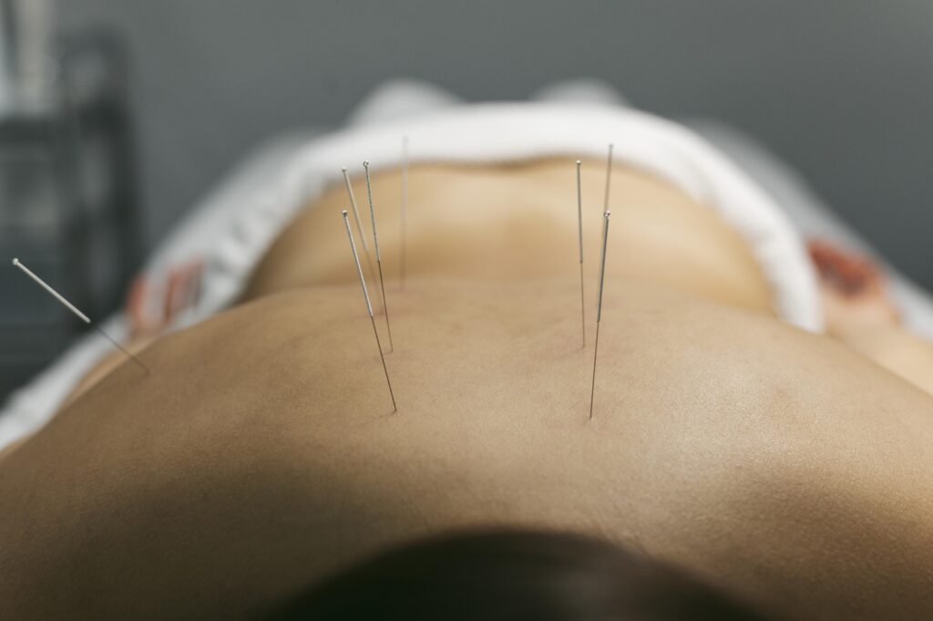 acupunturista em consulta, consultório de acupuntura, técnicas de acupuntura
